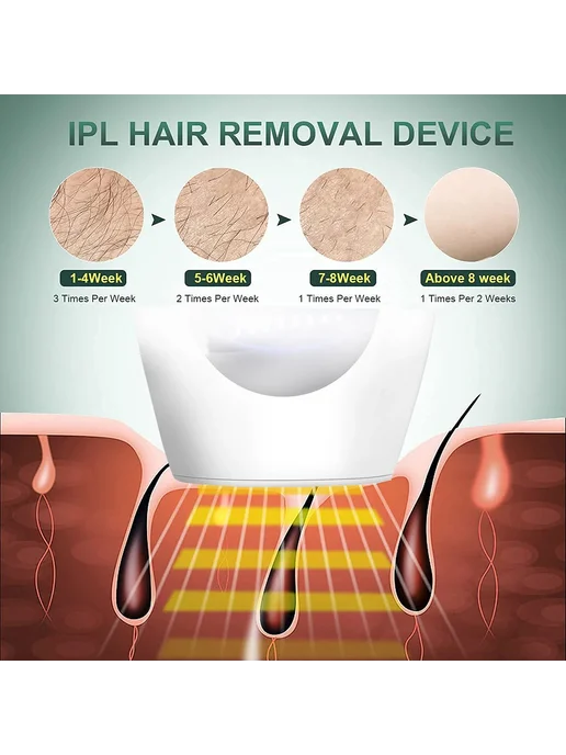 kodo Эпилятор IPL 900000 импульсов ДжП 2023-White, белый, фото 7