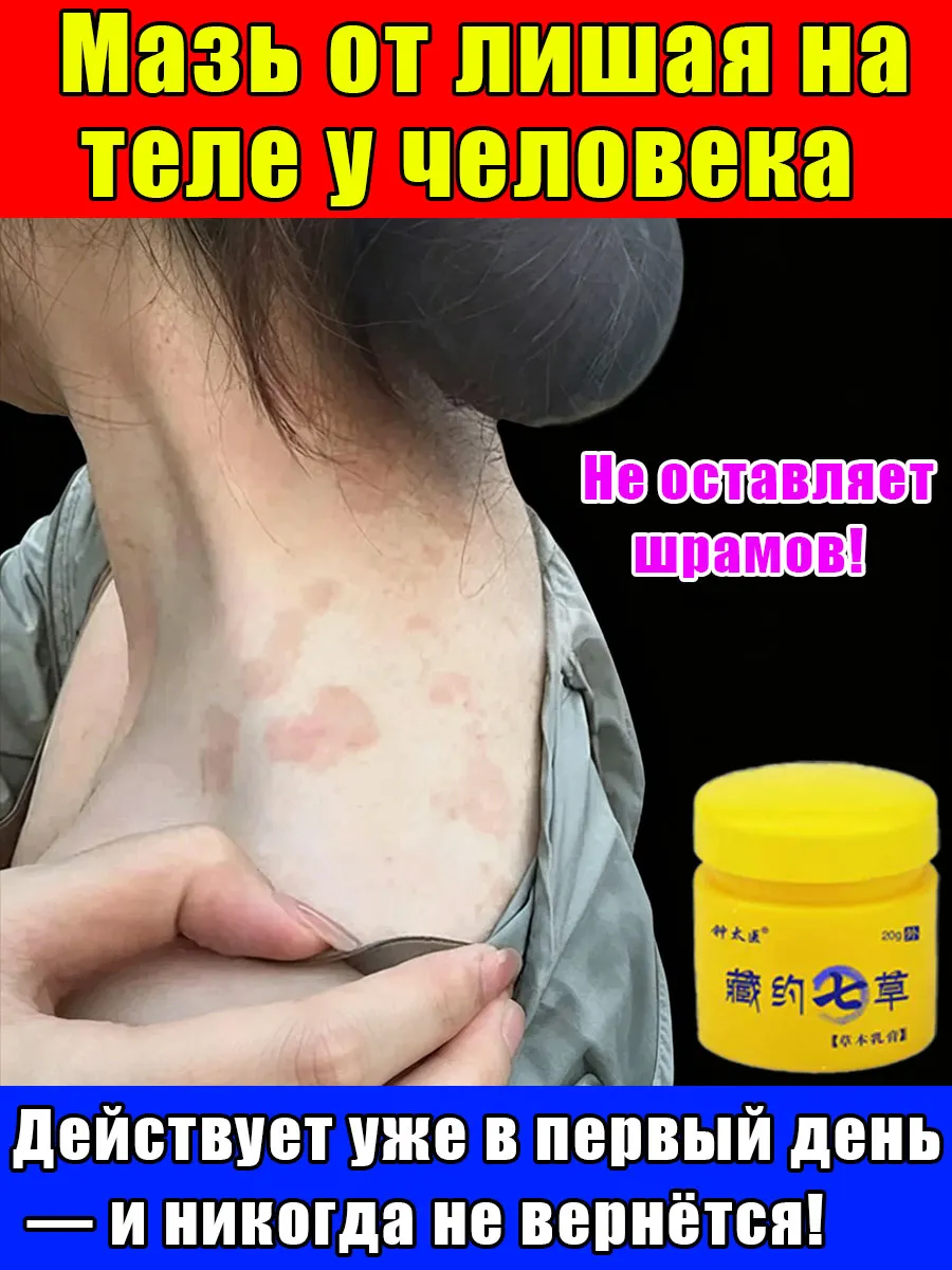 Мазь от лишая на теле у человека