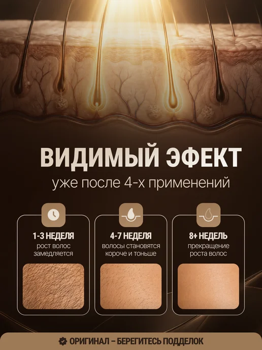 Luverance Фотоэпилятор лазерный удаления волос профессиональный 25 Дж, вариант, фото 5