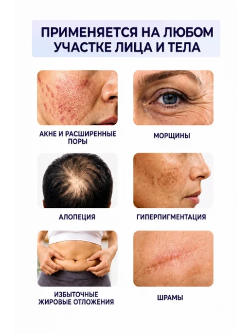 Картридж 9 игл для аппарата мезотерапии дермапен, 5 шт, 5 шт, фото 2