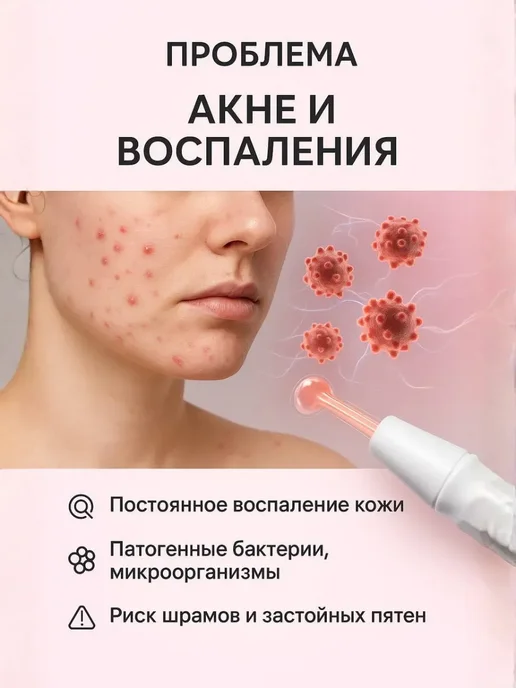 bumblestar Дарсонваль прибор для ухода за кожей и волосами, для дома, белый, фото 2