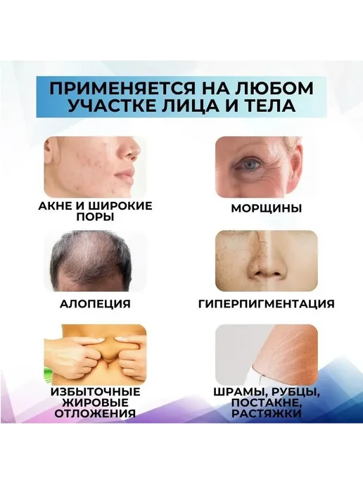 Винтовые картриджи для дермапена, 36 игл, 10 шт, 10 шт, фото 6