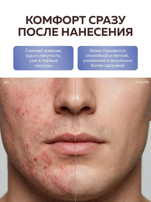 Крем после бритья мужской Snobb 100% натуральный, Miko 30 мл, 30 мл, фото 3
