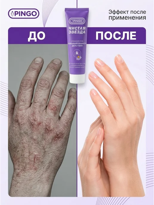 PINGO. Защитный крем для рук при технических и садовых работах, 100 мл, фото 5
