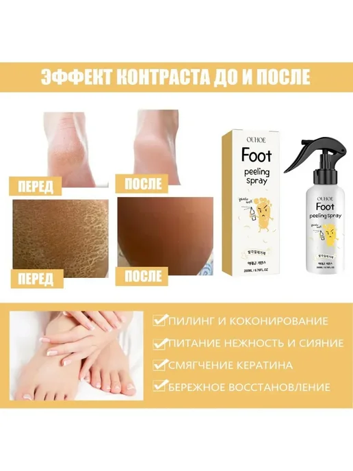 Ouhoe Спрей для отшелушивания кожи стоп, 200 мл, фото 3