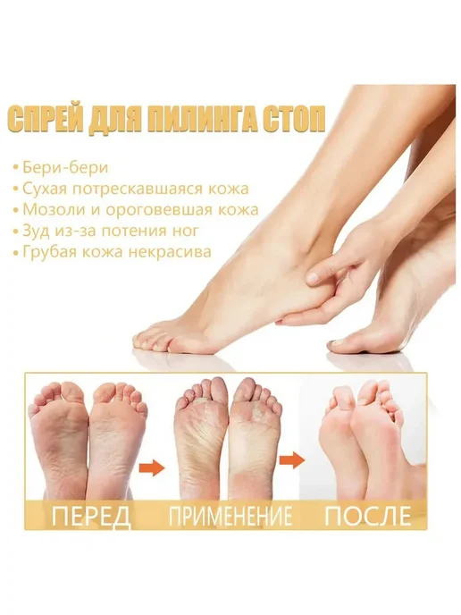 Ouhoe Спрей для отшелушивания кожи стоп, 200 мл, фото 4