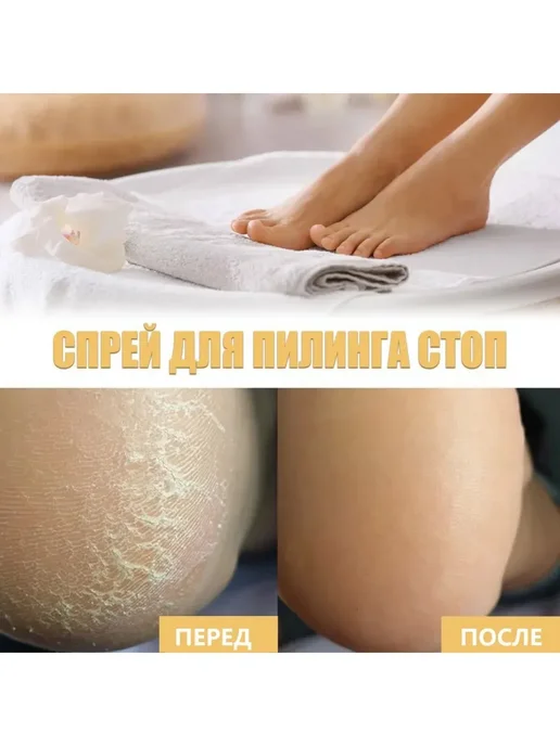 Ouhoe Спрей для отшелушивания кожи стоп, 200 мл, фото 6