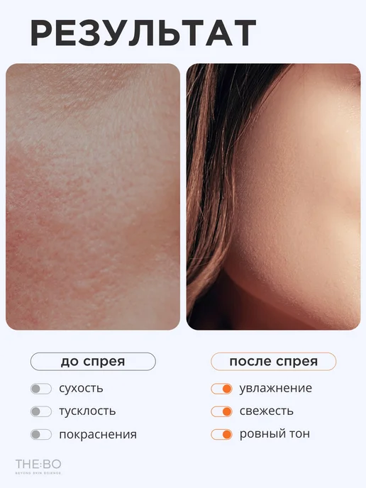 Увлажняющий мист для лица с гиалуроновой кислотой, 150 мл, 150 мл, фото 4