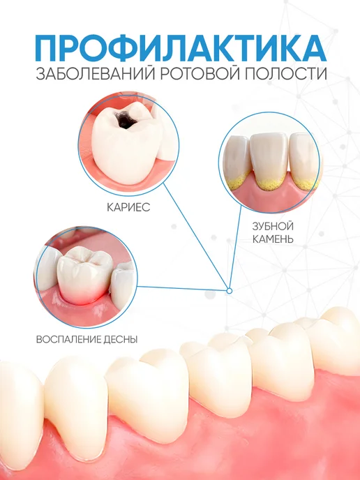Межзубные ершики L (1.4 мм), 6 шт для брекетов, 6 шт, фото 6