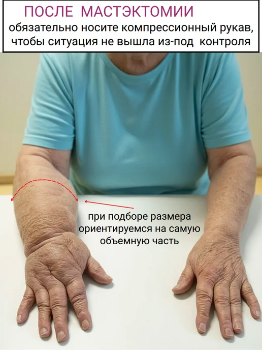Альмед Компрессионный рукав 2 класс, бежевый, фото 6