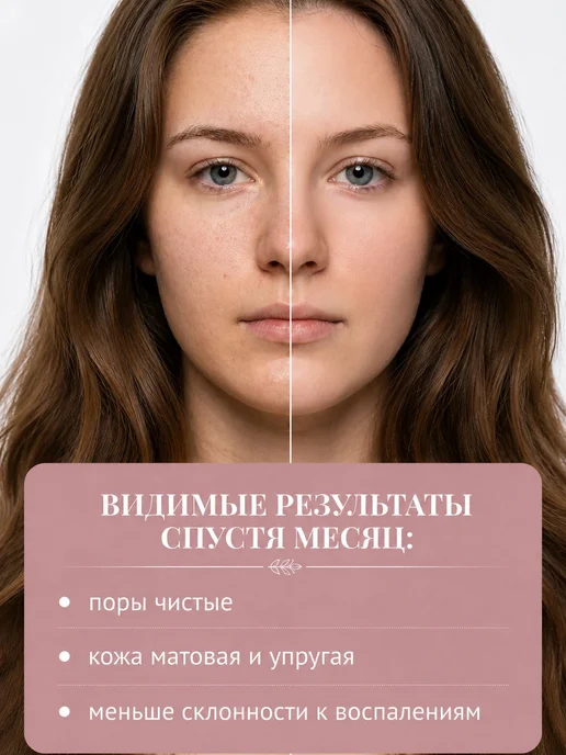 Матирующий гидролат чабреца, натуральный спрей для лица и мл, вариант, фото 6