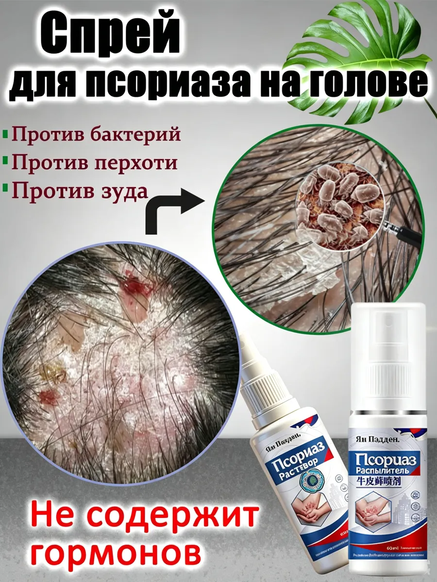 Спрей от псориаза на голове