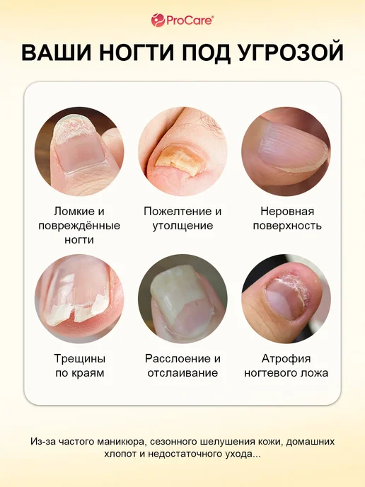 Кератиновый крем для восстановления и укрепления ногтей, вариант, фото 2