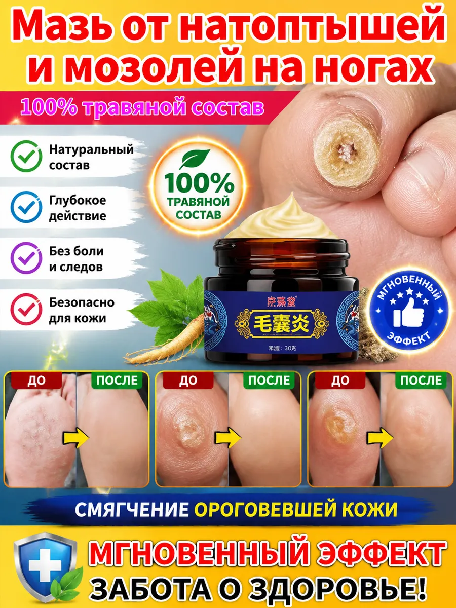 мазь от мозолей между пальцами на ногах