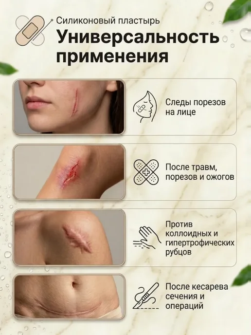 Силиконовый пластырь от шрамов и рубцов 8 шт, 8 шт, фото 8