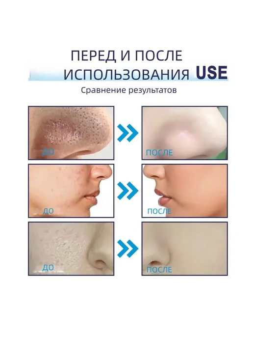 Черная угольная маска убирать прыщи Отшелушивающий гладкий, черный, фото 6