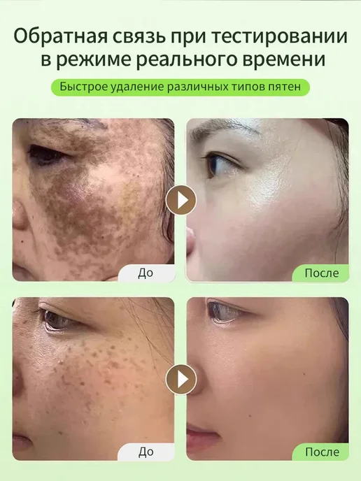 Отбеливающее мыло от пигментных пятен для лица и всего тела, вариант, фото 7